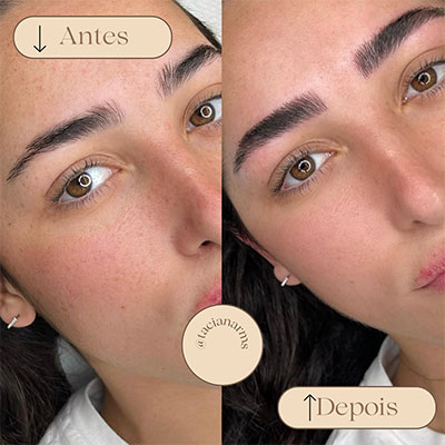 Antes/Depois da Micropigmentação Essence Brow