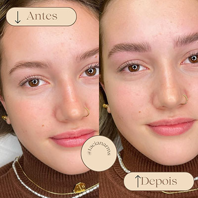 Antes/Depois da Micropigmentação Essence Brow