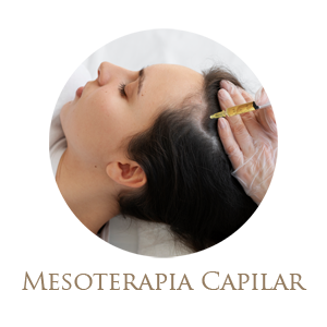 Mesoterapia Capilar